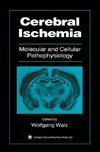 Cerebral Ischemia