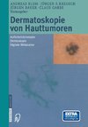 Dermatoskopie von Hauttumoren