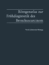 Röntgenatlas zur Frühdiagnostik des Bronchuscarcinom