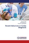 Recent Advances in Caries Diagnosis