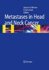 Metastases in Head and Neck Cancer