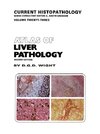 Atlas of Liver Pathology