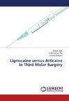 Lignocaine versus Articaine in Third Molar Surgery