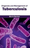 Diagnosis and Management of Tuberculosis