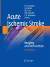 Acute Ischemic Stroke