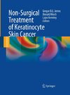 Non-Surgical Treatment of Keratinocyte Skin Cancer