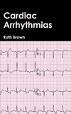 Cardiac Arrhythmias