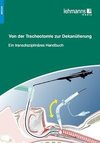 Von der Tracheotomie zur Dekanülierung