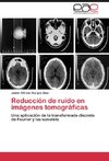 Reducción de ruido en imágenes tomográficas