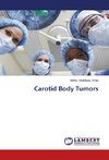 Carotid Body Tumors