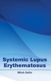 Systemic Lupus Erythematosus