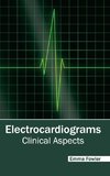 Electrocardiograms