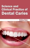 Science and Clinical Practice of Dental Caries