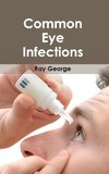 Common Eye Infections