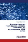 Identifikaciya belkovyh markerov gepatita S na poverhnosti ASM-chipov