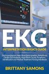 EKG Interpretation Basics Guide