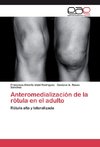 Anteromedialización de la rótula en el adulto