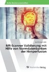 MR-Scanner Validierung mit Hilfe von Normdatenbanken der Hirnperfusion