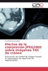 Efectos de la compresión JPEG2000 sobre imágenes TAC de cráneo