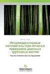 Intramedullyarnye implantaty pri lechenii perelomov dlinnyh trubchatyh kostej