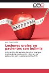 Lesiones orales en pacientes con bulimia