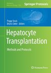 Hepatocyte Transplantation