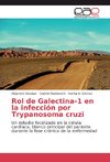 Rol de Galectina-1 en la infección por Trypanosoma cruzi