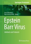 Epstein Barr Virus