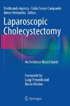 Laparoscopic Cholecystectomy