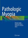 Pathologic Myopia