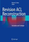 Revision ACL Reconstruction