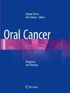 Oral Cancer