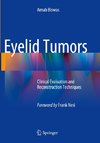 Eyelid Tumors