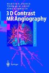 3D Contrast MR Angiography