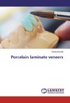 Porcelain laminate veneers