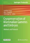 Cryopreservation of Mammalian Gametes and Embryos