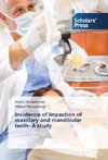 Incidence of Impaction of maxillary and mandibular teeth- A study