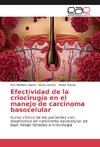 Efectividad de la criocirugía en el manejo de carcinoma basocelular