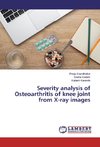 Severity analysis of Osteoarthritis of knee joint from X-ray images