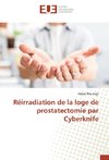 Réirradiation de la loge de prostatectomie par Cyberknife