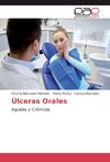 Úlceras Orales