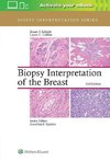 Biopsy Interpretation of the Breast (Biopsy Interpretation Series)