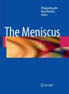 The Meniscus