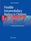 Flexible Intramedullary Nailing in Children