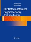 Illustrated Anatomical Segmentectomy for Lung Cancer