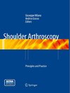 Shoulder Arthroscopy