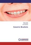 Ceramic Brackets