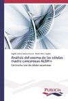 Análisis del exoma de las células madre cancerosas ALDH+