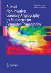 Atlas of Non-Invasive Coronary Angiography by Multidetector Computed Tomography