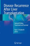 Disease Recurrence After Liver Transplantation